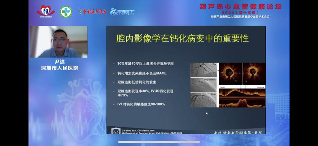 葫蘆島心血管健康論壇?2022｜創(chuàng)新驅(qū)動發(fā)展，不斷提升心血管疾病救治能力(圖11)